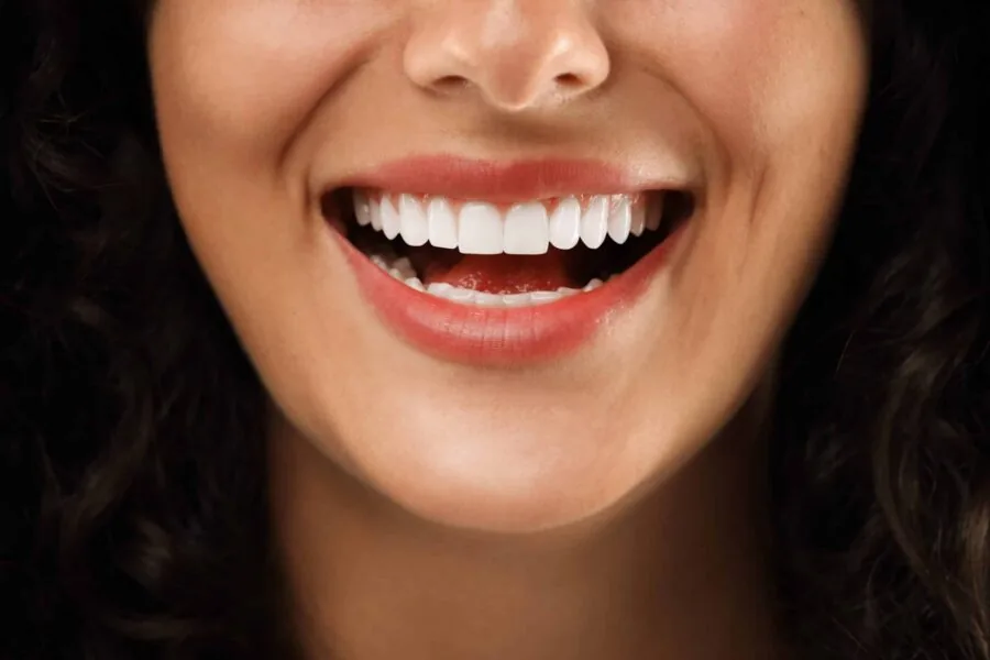 A smiling woman with bright, even teeth